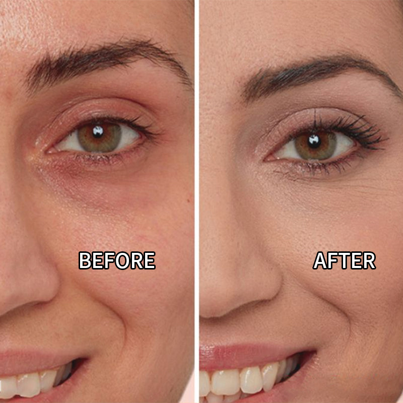 🪻Final 3 Hours: 70% OFF🫧tarfe colored clay undereye corrector